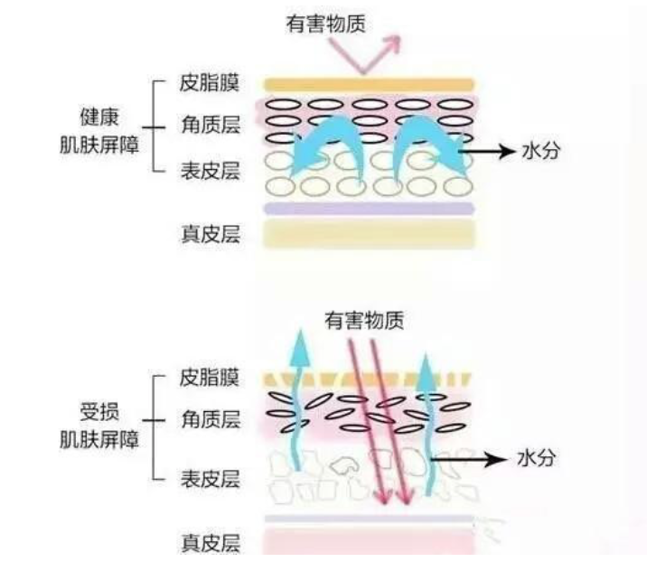 干、癢、紅、腫？別慌涂護(hù)膚品，先看看皮膚屏